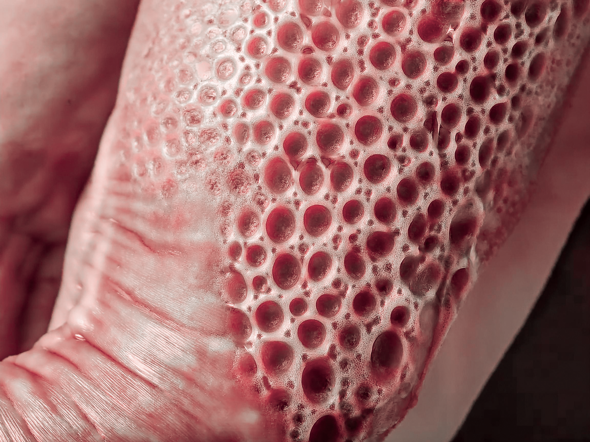 Trypophobia