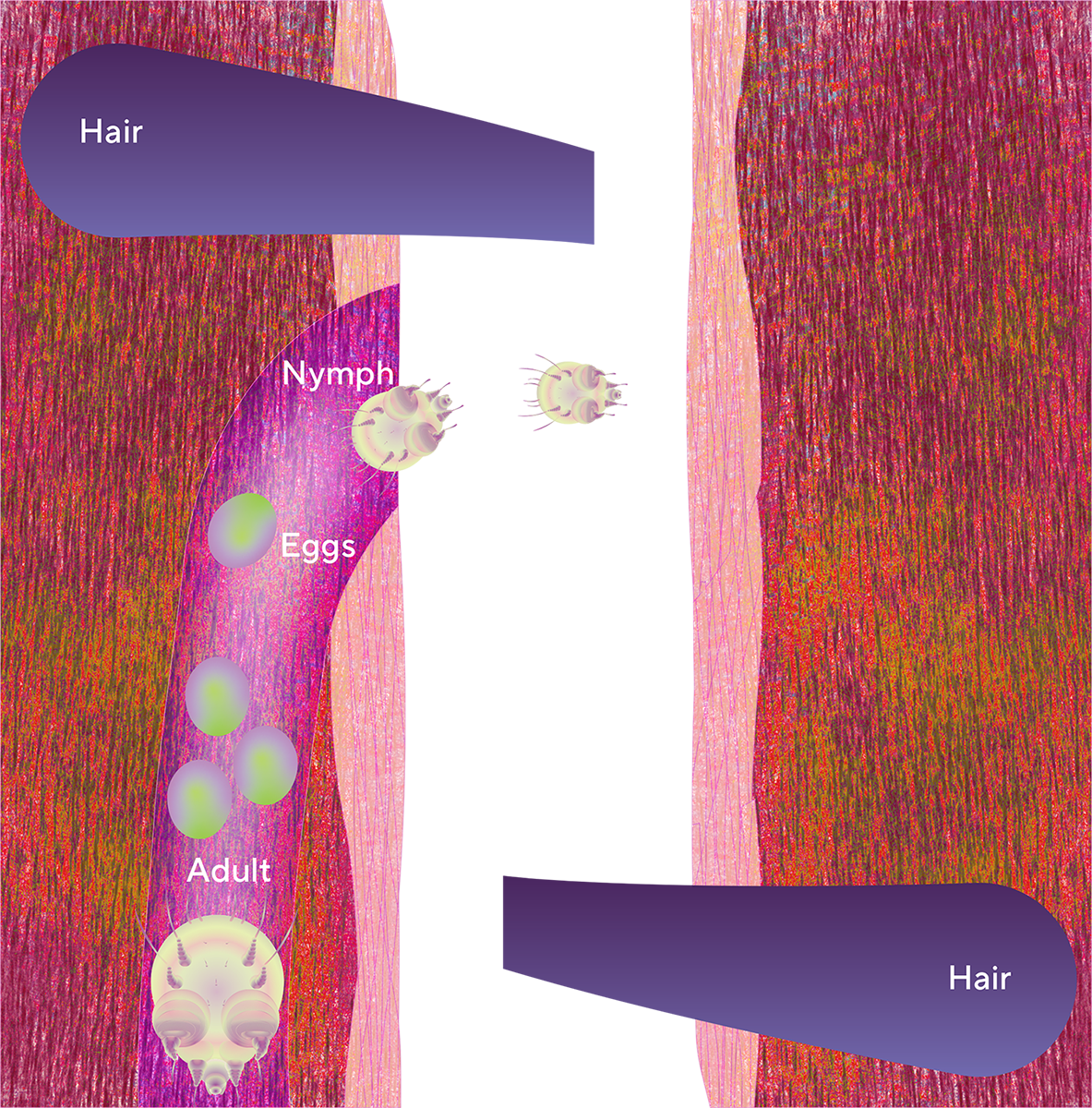 Transmission Scabies